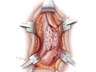 Urología en Madrid, Andrología, Disfuncion Erectil, Dr. Luis Fiter